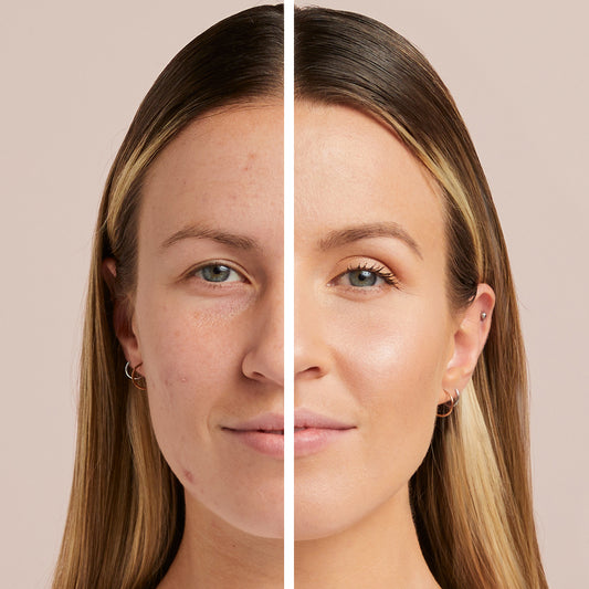 Skin Perfector Undereye Corrector Pen | Before and After | DB Cosmetics